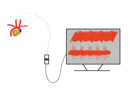 Cardiovascular recording diagrams